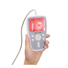 Handheld Video Colposcope Equipment Camera For Gynecology